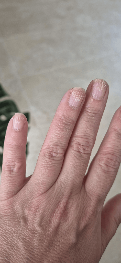 Hydration 1 Hydration for healthy nails in the high desert, showing dryness and brittle nail texture